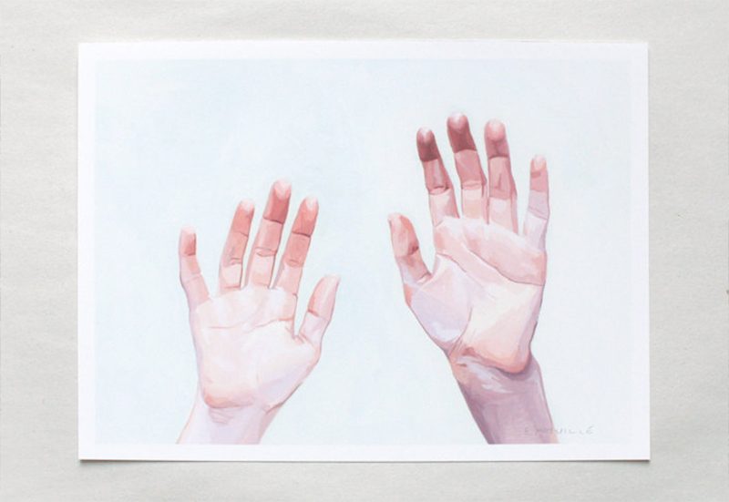 How my fiancé lost his finger tips and our friends saved our wedding