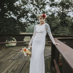 This stunning bald bride proves hair is never necessary to steal hearts